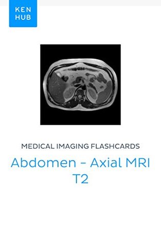 Download Medical Imaging flashcards: Abdomen - Axial MRI T2: Learn all muscles, bones, arteries, veins, organs and mri on the go (Kenhub Flashcards Book 58) - Kenhub | PDF